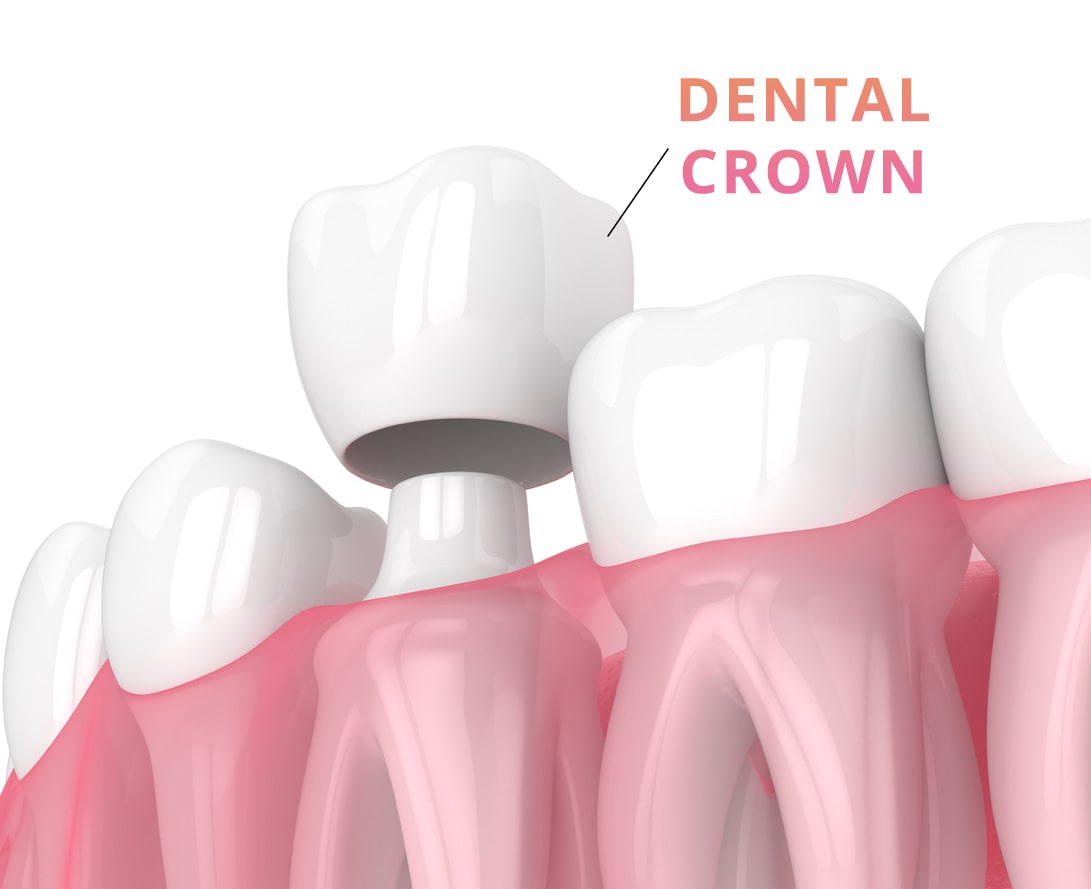 crown