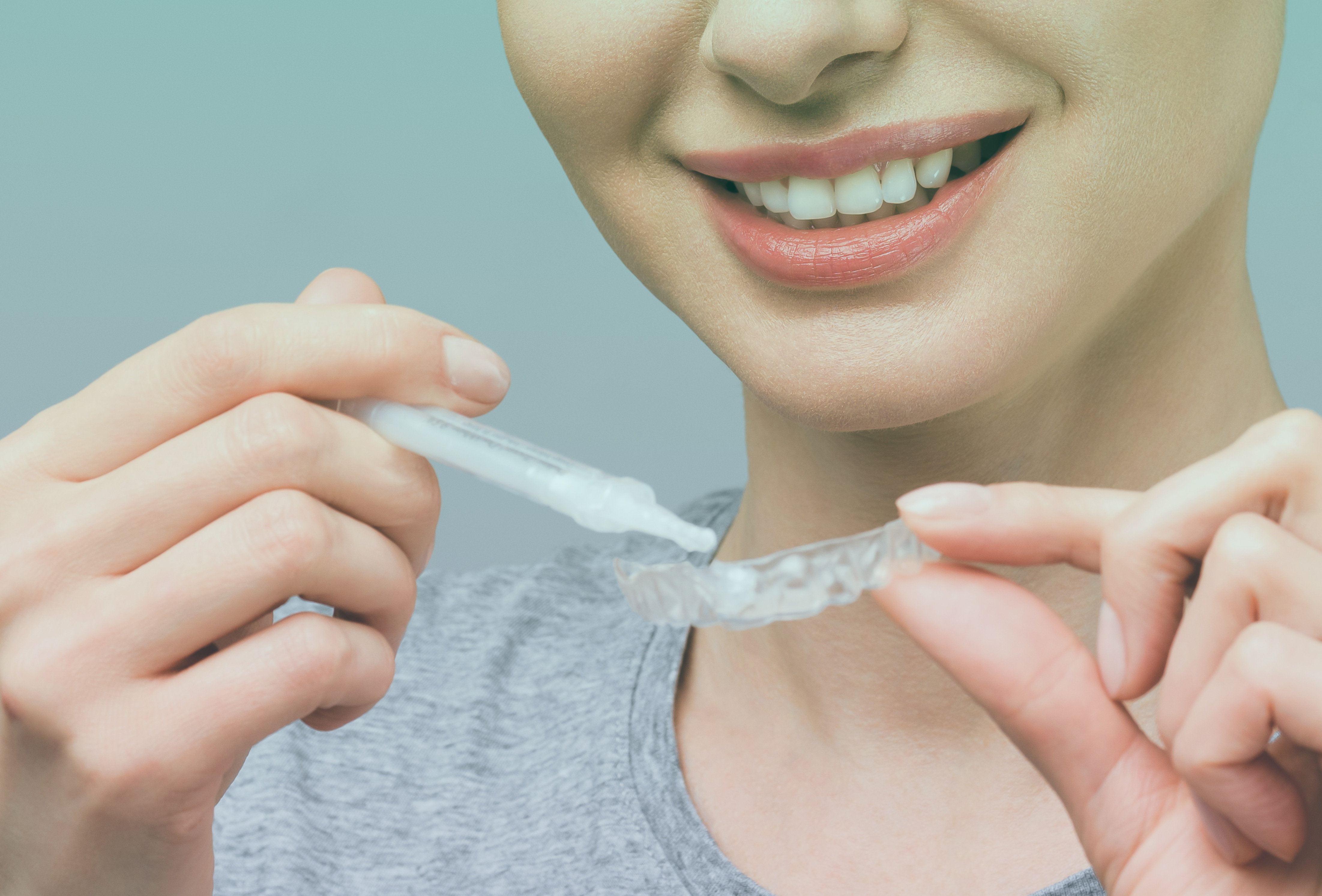 Tooth whitening with custom-made trays in Northern Ireland
